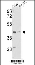 Anti-ACTG1 Rabbit Polyclonal Antibody