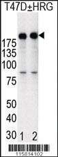 Anti-ERBB2 Rabbit Polyclonal Antibody