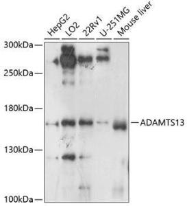 Antibody anti-ADAMTS13 100 µl