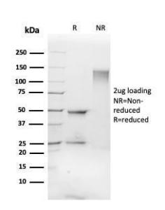 SDS-PAGE analysis of Anti-FLI1 Antibody [FLI1/3183] under non-reduced and reduced conditions; showing intact IgG and intact heavy and light chains, respectively. SDS-PAGE analysis confirms the integrity and purity of the antibody.