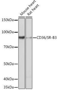 Western blot analysis of extracts of various cell lines, using Anti-CD36 Antibody [ARC0461] (A305845) at 1:1,000 dilution The secondary antibody was Goat Anti-Rabbit IgG H&L Antibody (HRP) at 1:10,000 dilution Lysates/proteins were present at 25 µg per lane