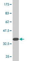 Anti-LHX2 Mouse Monoclonal Antibody [clone: 1E6]