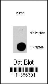 Anti-TSC2 Rabbit Polyclonal Antibody (HRP (Horseradish Peroxidase))