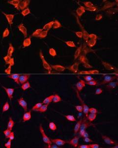 Antibody anti-ADAMTS13 100 µl