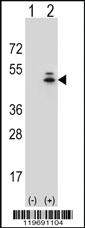 Anti-ACTG1 Rabbit Polyclonal Antibody