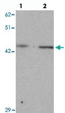 Anti-LMX1B Rabbit Polyclonal Antibody