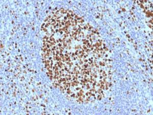 Immunohistochemical analysis of formalin-fixed, paraffin-embedded human tonsil using Anti-MCM7 Antibody [SPM379]