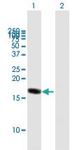 Anti-RHEB Mouse Polyclonal Antibody