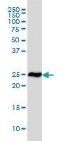 Anti-RPL19 Mouse Monoclonal Antibody [clone: 3H4]