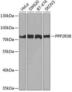 Western blot analysis of extracts of various cell lines, using Anti-PPP2R3B Antibody (A10435) at 1:1,000 dilution The secondary antibody was Goat Anti-Rabbit IgG H&L Antibody (HRP) at 1:10,000 dilution Lysates/proteins were present at 25 µg per lane