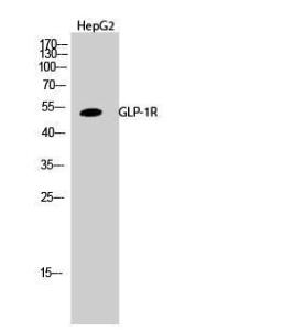 Western blot analysis of HepG2 cells using Anti-GLP1R Antibody