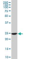 Anti-RPL19 Mouse Monoclonal Antibody [clone: 3H4]