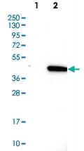 Anti-SNRNP40 Rabbit Polyclonal Antibody