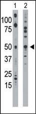 Anti-ETNK1 Rabbit polyclonal antibody