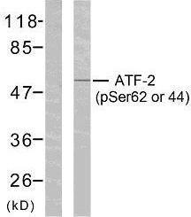 Western blot analysis of lysates from HeLa cells treated with TNF-alpha using Anti-ATF2 (phospho Ser62 or 44) Antibody. The left hand lane represents a negative control, where the Antibody is blocked by the immunising peptide