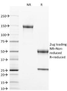 Anti-CD40 antibody