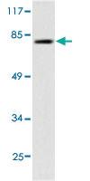 Anti-TYR Rabbit Polyclonal Antibody