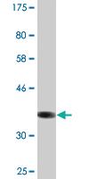 Anti-SLC22A6 Mouse Monoclonal Antibody [clone: 1F2]