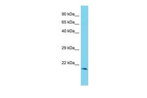 Anti-MRPL48 Rabbit Polyclonal Antibody