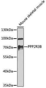 Western blot analysis of extracts of mouse skeletal muscle, using Anti-PPP2R3B Antibody (A10435) at 1:1,000 dilution The secondary antibody was Goat Anti-Rabbit IgG H&L Antibody (HRP) at 1:10,000 dilution Lysates/proteins were present at 25 µg per lane