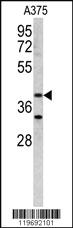 Anti-ACTR2 Rabbit Polyclonal Antibody