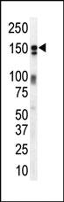 Anti-ERBB3 Rabbit Polyclonal Antibody