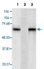 Anti-HSPA8 Mouse Monoclonal Antibody [clone: 1F2-H5]