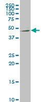 Anti-NTNG2 Mouse Monoclonal Antibody [clone: 4F11]