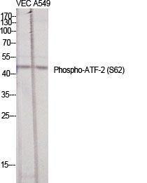 Western blot analysis of various cells using Anti-ATF2 (phospho Ser62 or 44) Antibody