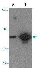 Anti-H5 Mouse Monoclonal Antibody [clone: 7B9B2]