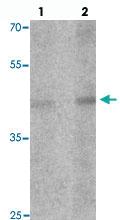 Anti-LMX1A Rabbit Polyclonal Antibody