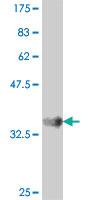 Anti-CALCA Mouse Polyclonal Antibody