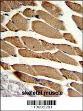 Anti-ACTR2 Rabbit Polyclonal Antibody