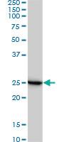 Anti-RPL19 Mouse Monoclonal Antibody [clone: 3H4]