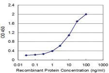 Anti-SLC7A7 Mouse Monoclonal Antibody [clone: 3B10]