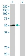 Anti-TEX13A Rabbit Polyclonal Antibody