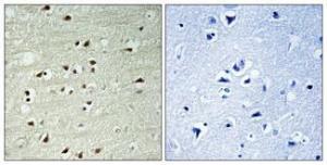 Antibody anti-RPC2 100 µg