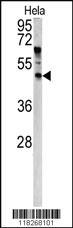 Anti-ANGPTL7 Rabbit Polyclonal Antibody