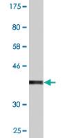 Anti-SCYL3 Mouse Monoclonal Antibody [clone: 3D3]