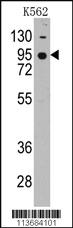 Anti-CDH7 Rabbit Polyclonal Antibody