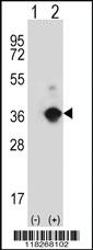 Anti-ANGPTL7 Rabbit Polyclonal Antibody