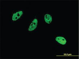 Anti-CREM Mouse Monoclonal Antibody [clone: 3B5]