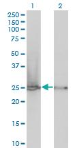 Anti-RPL19 Mouse Monoclonal Antibody [clone: 3H4]