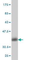 Anti-CALCA Mouse Monoclonal Antibody [clone: 4B10]