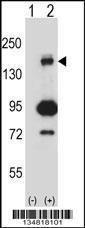 Anti-MAP3K5 Rabbit Polyclonal Antibody (AP (Alkaline Phosphatase))