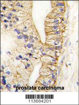 Anti-CDH7 Rabbit Polyclonal Antibody