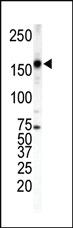 Anti-ZEB1 Mouse Monoclonal Antibody