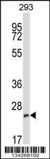 Anti-BCAP29 Rabbit Polyclonal Antibody (AP (Alkaline Phosphatase))