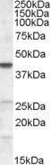 Anti-ABHD5 Antibody (A82503) (0.2 µg/ml) staining of NIH3T3 lysate (35 µg protein in RIPA buffer). Detected by chemiluminescence