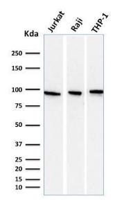 Western blot analysis of Jurkat, Raji, and THP-1 cell lysates using Anti-Transferrin Receptor Antibody [DF1513]